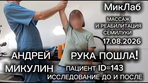 Пациент ID=143 Исследование ДО и ПОСЛЕ. Рука ПОШЛА! Массаж и Реабилитация в Семилуках