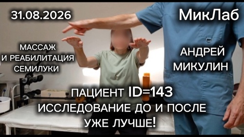 Пациент ID=143 Исследование ДО и ПОСЛЕ. Уже ЛУЧШЕ! Массаж и Реабилитация в Семилуках. Микулин А.Л