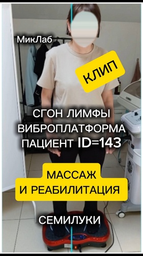 Сгон ЛИМФЫ. Вибро Платформа. Клип. Пациент ID=143